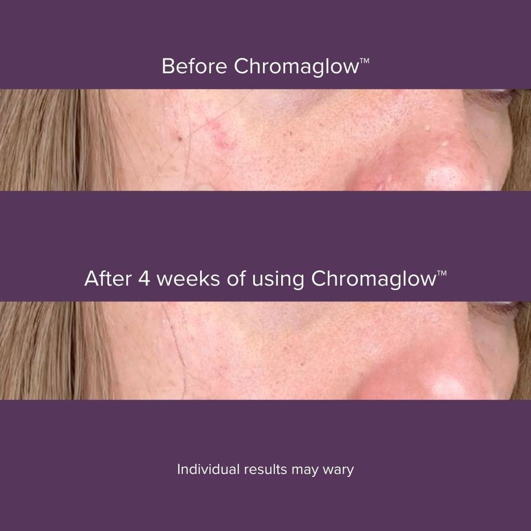 Luyors - Vendita all'ingrosso Dispositivi elettronici per la cura della pelle - Chromaglow™ Bastoncino per la Cura della Pelle a 7 Colori6