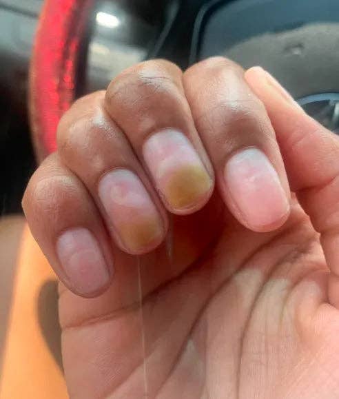 Naturally My Sister’s Keeper - Wholesale Foot Cream - Advanced Fungal Treatment for Feet and Nails14