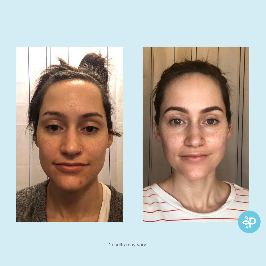 Perfect Image - Vendita all'ingrosso Peeling viso - Tri-Clarity Peel Pads - Livello 14