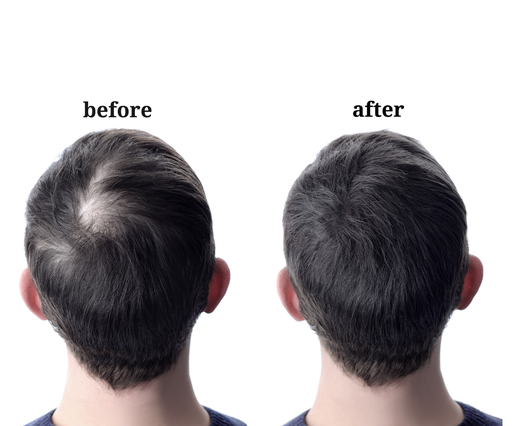 Hairresurrection - Wholesale Hair Oil - Intense Hair Growth Oil4