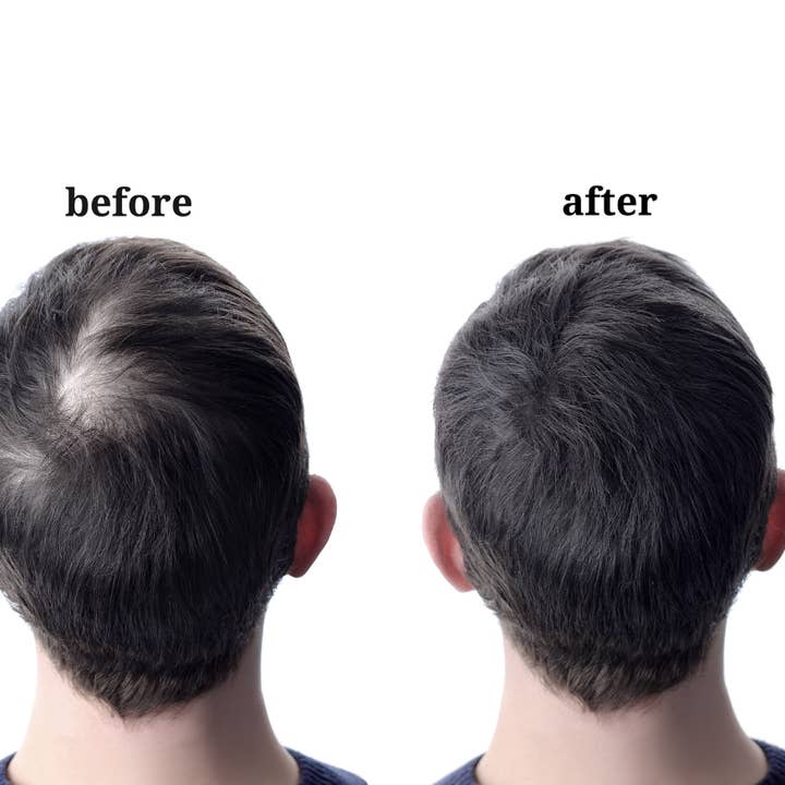 Hairresurrection - Wholesale Hair Oil - Intense Hair Growth Oil4