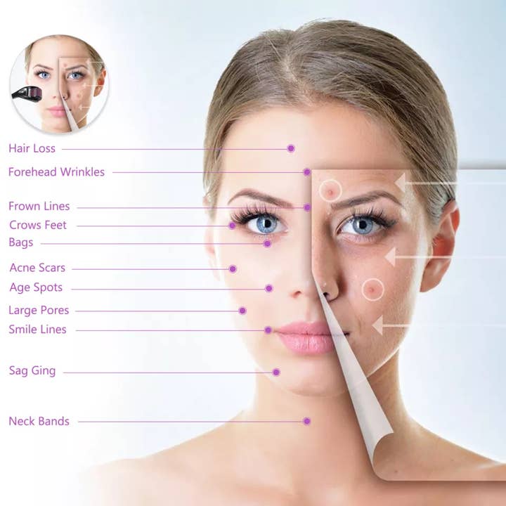 VIGOR - Wholesale Face/beauty roller - Perfect Spa Facial Mars Doctor Roller System2