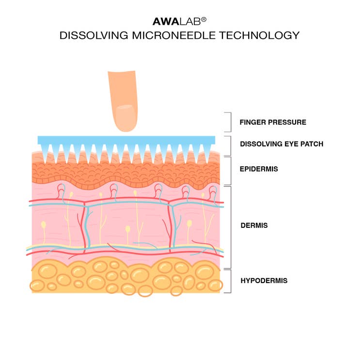 Awalab - Vendita all'ingrosso Maschere trattamento occhi - Patch oculari dissolventi con microneedle, trattamento che stimola la pelle