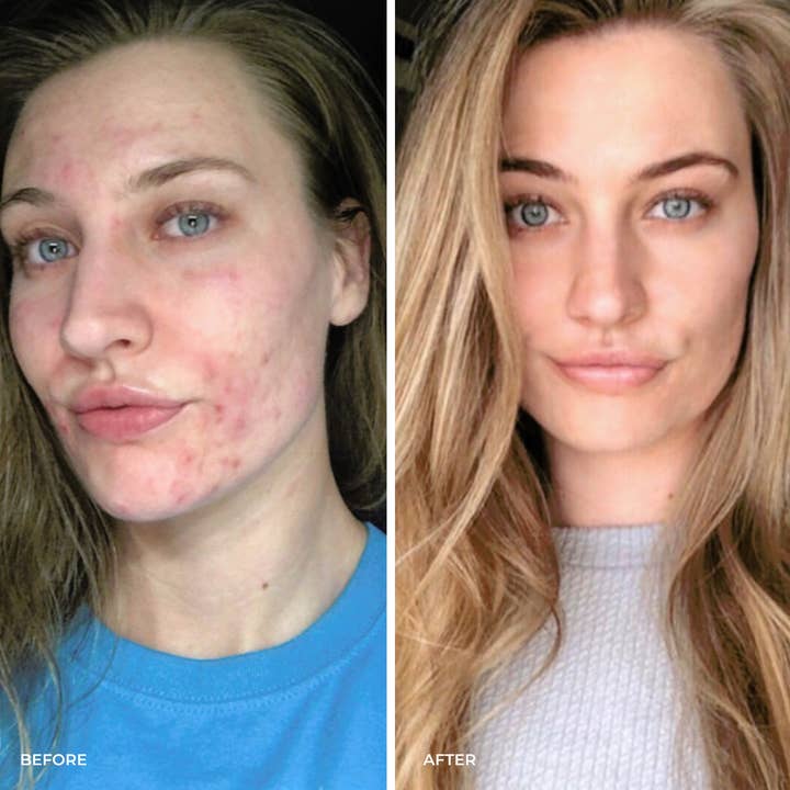 The Golden Secrets - Vendita all'ingrosso Olio viso - Olio viso Youth Beauty6