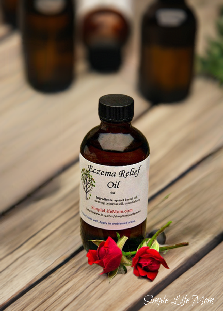 Simple Life Mom - Wholesale Bath/Body Oil - ECZEMA RELIEF OIL - 4oz soothe irritated, dry skin, organic body oil with essential oils, dermatitis oil1