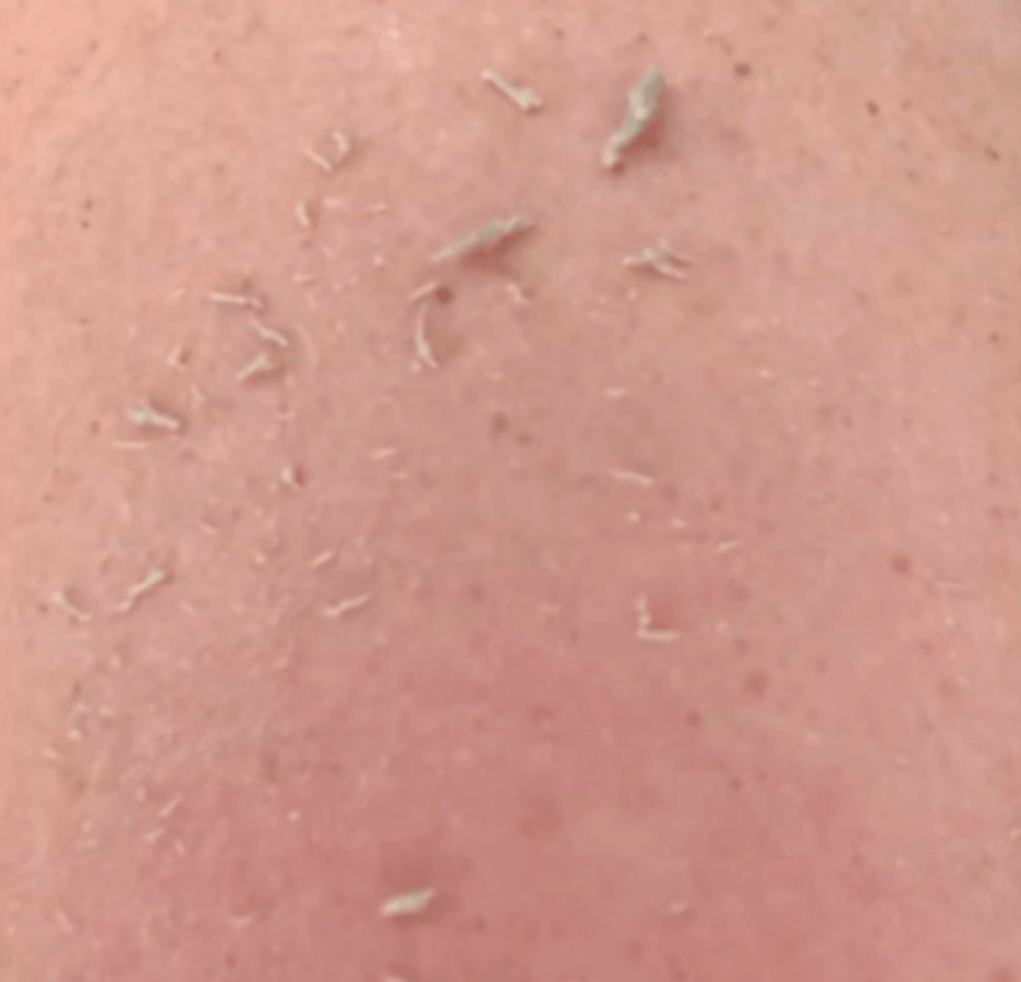 Wildpier Beauty – Engroshandel Eksfolierende handsker/vanter – Wildpier ™️ Deep Exfoliating Handske og Konjac Sponge Double B4