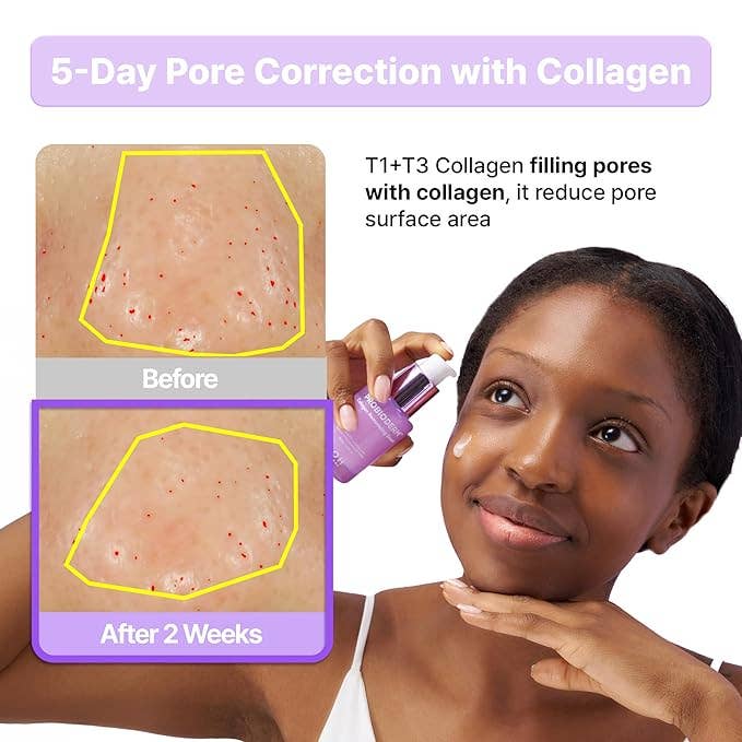 Glowiss - Wholesale Facial Serum/Concentrate - BIOHEAL BOH Probiodermâ„¢ Collagen Remodeling Serum 1.01 fl oz (30 ml)