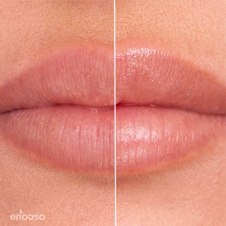 Enooso - Wholesale Lip Balm - Blackberry and Blueberry Lip Balm4