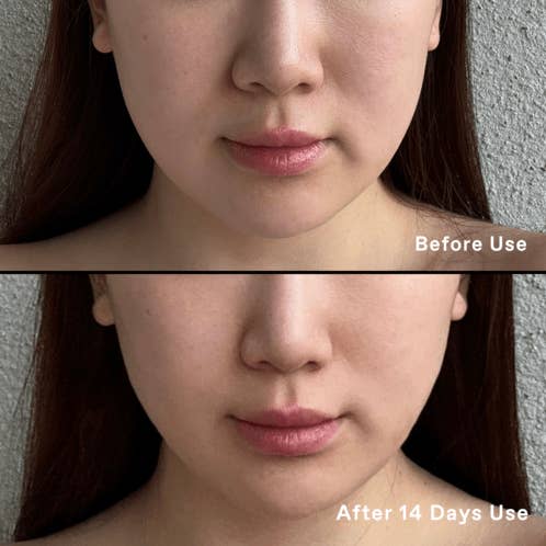 KORRES USA LTD - Wholesale Facial Serum/Concentrate - Black Pine Up-Lift Contouring Serum4