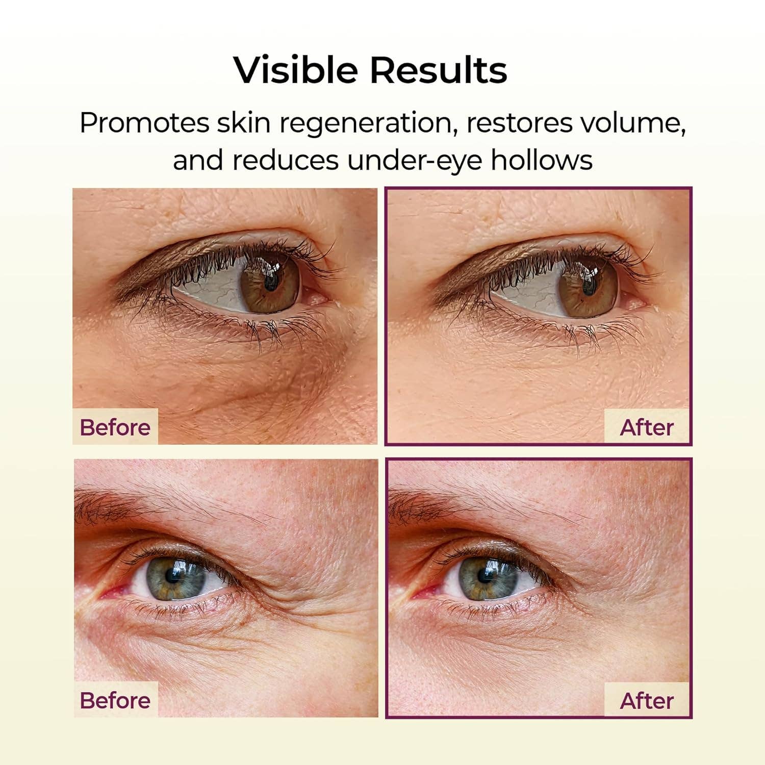 MEHIAZ - Wholesale Eye Cream/Gel - Dr.Melaxin Cemenrete Calcium Multi Balm 9g3