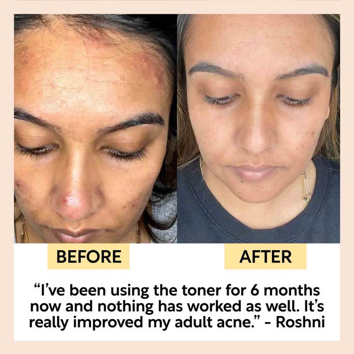 UpCircle USA - Wholesale Facial Toner - Vegan Face Toner with Hyaluronic Acid - Travel Size