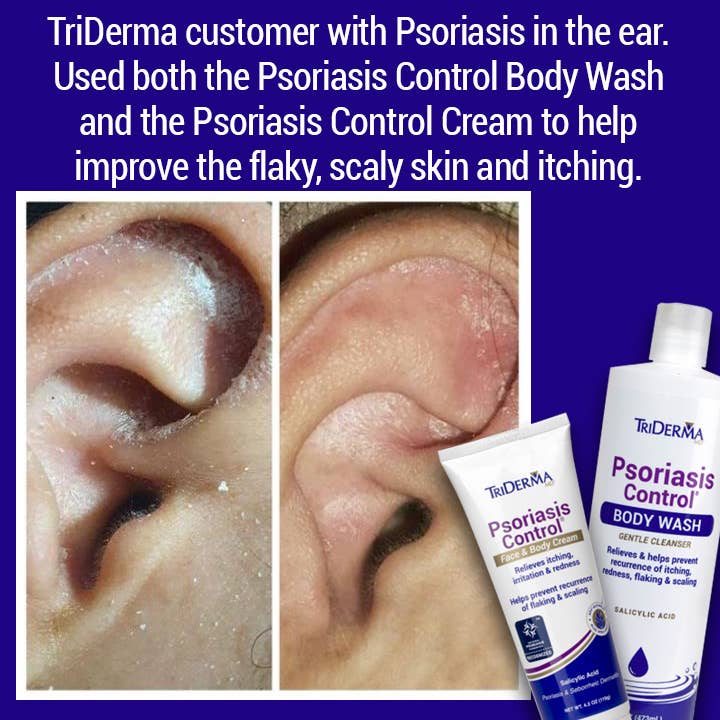 TriDerma MD - Wholesale Body Wash/douchegel - Psoriasis Control Body Wash2