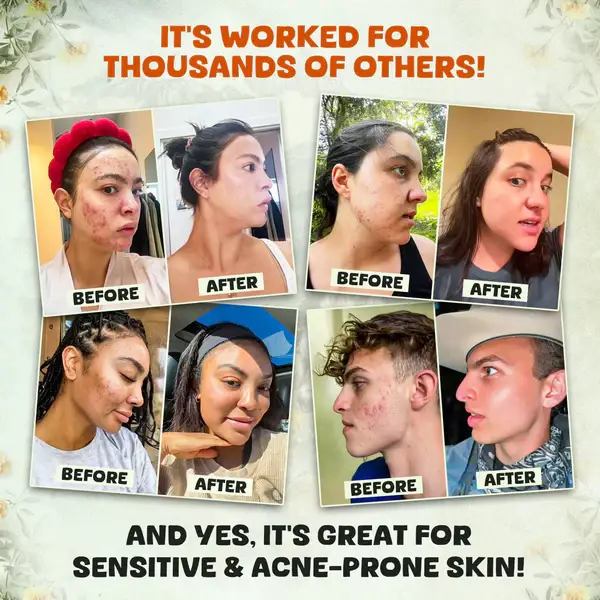 Moes Group - Wholesale Body Balm/Butter - Citrus + Whipped Tallow Honey Face Balm Evil Goods Skincare6