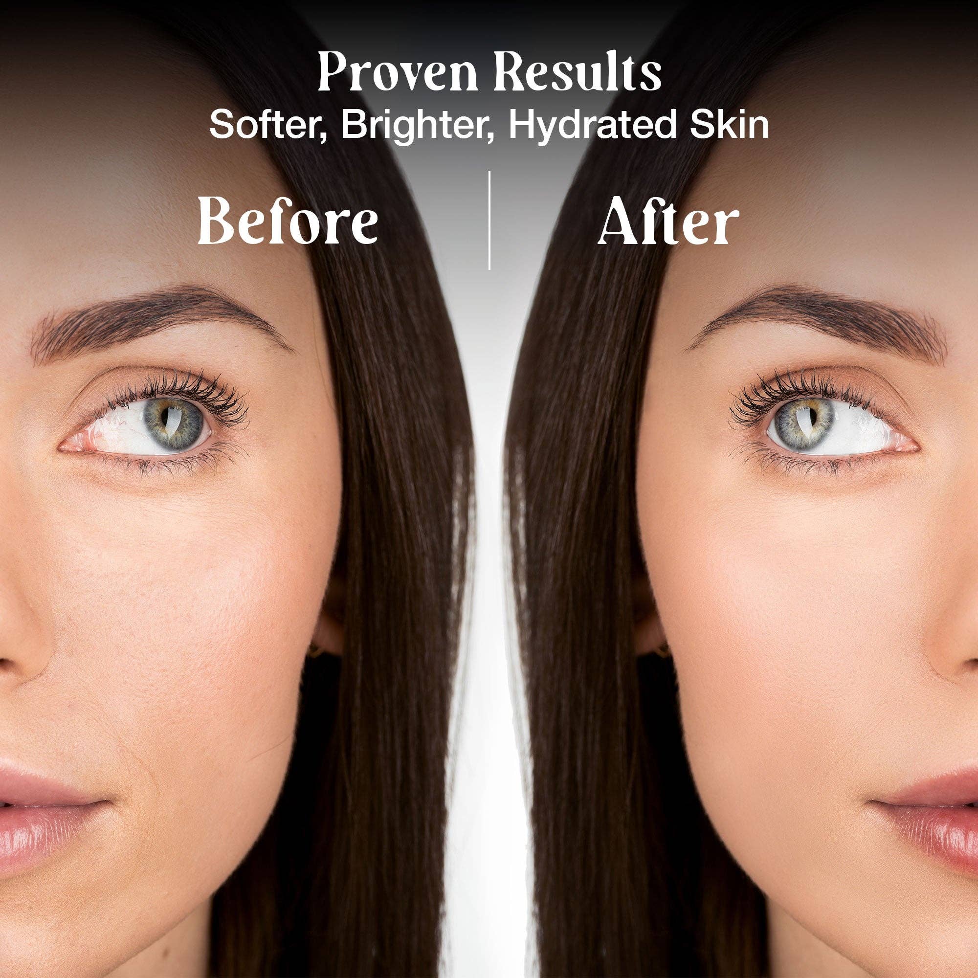 Livaclean - Wholesale Skincare Face Mask - 12 ct Collagen Face Mask with Superfoods5