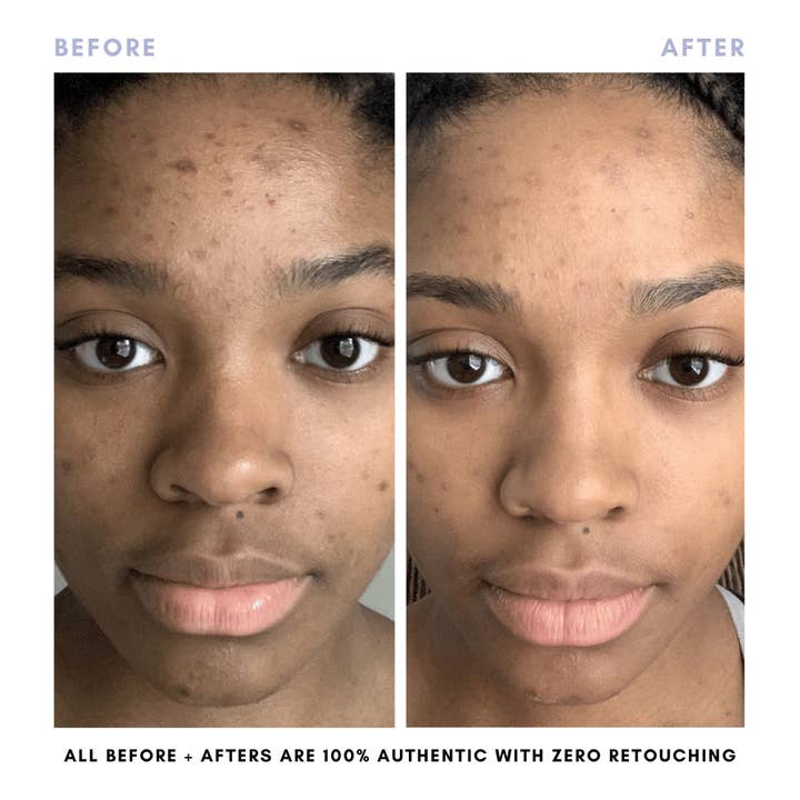 Clover By Clove + Hallow – Großhandel Gesichtspflege-Set – Das Juicy Skin Set5