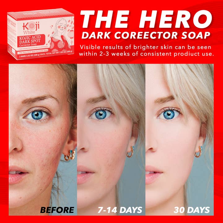 Koji White - Wholesale Facial Cleanser - Koji White Dark spot corrector Soap