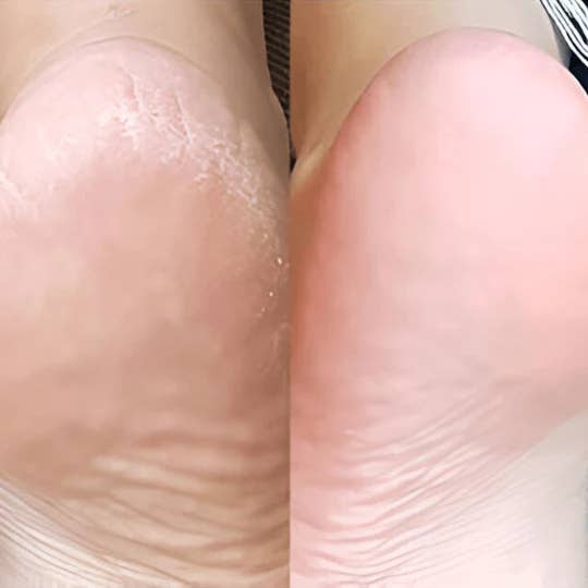 DERMEDEN - Wholesale Facial Moisturizer - Cicaderm Repair Care3