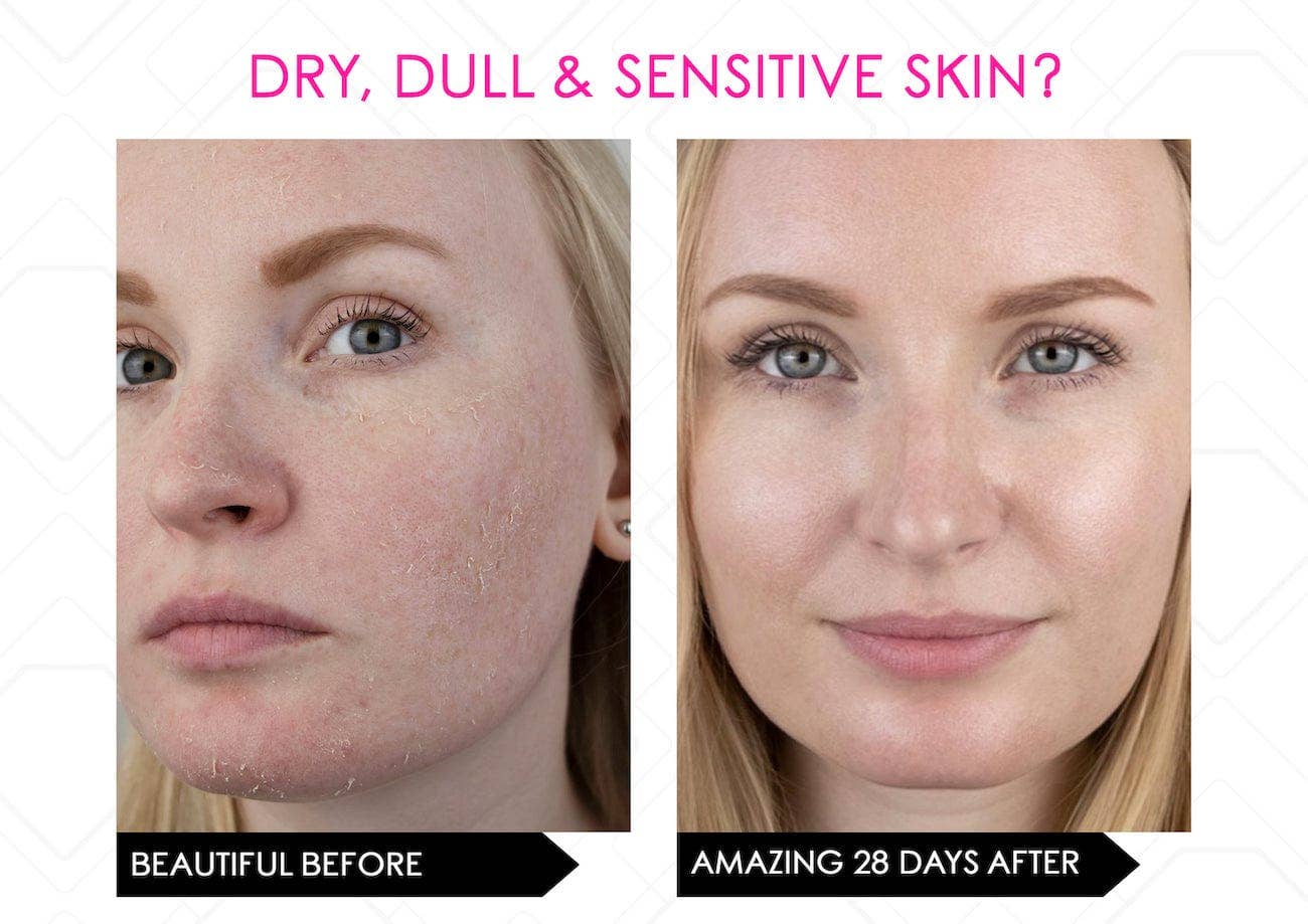 Mirenesse - Wholesale Electronic Skincare Device - LED Multi Light Therapy Mask, Electronic Skincare Device15