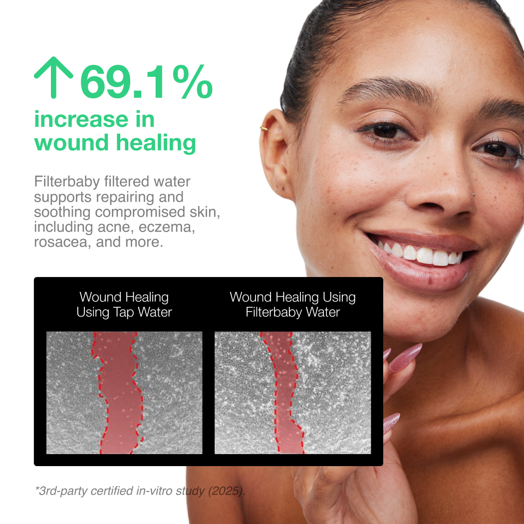 Filterbaby - Vendita all'ingrosso Rulli viso/di bellezza - Filtro per rubinetto Skincare Filterbaby 2.07