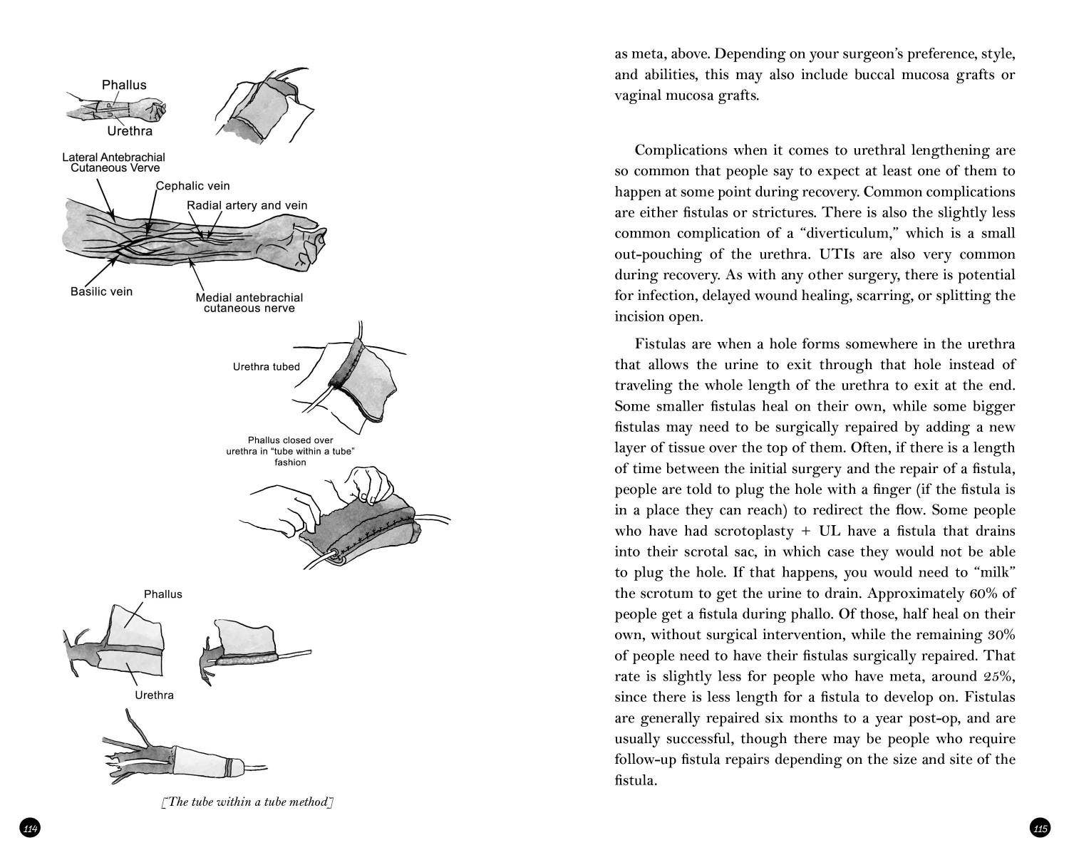 Microcosm Publishing & Distribution - Vente Livre sur la famille et les relations - Guide transmasculin de transition physique : pour les personnes trans, NB +6