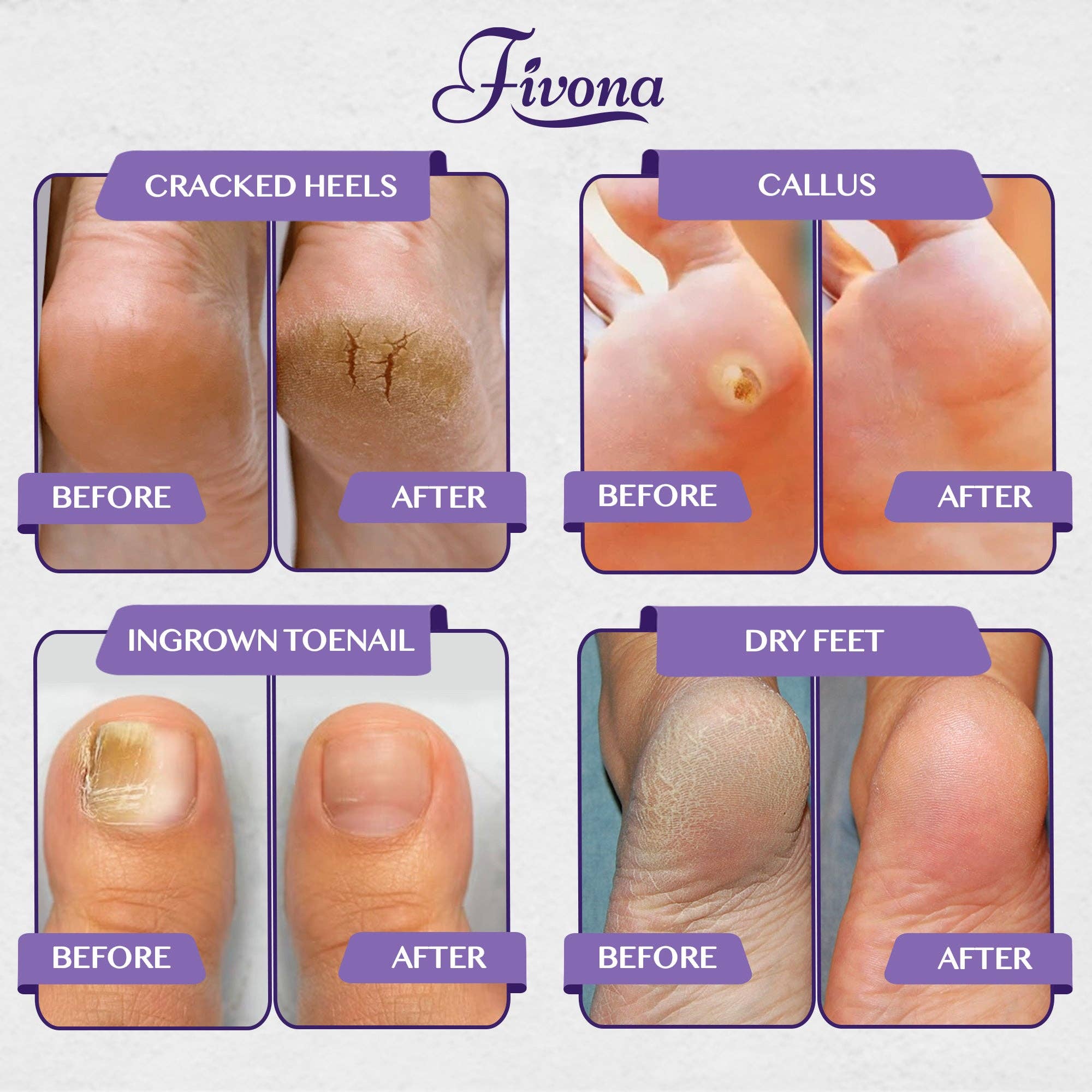 FIVONA - Wholesale Hand/Foot Soak - Foot Soak Epsom Salt with Oils - Lavender - 2Lb6