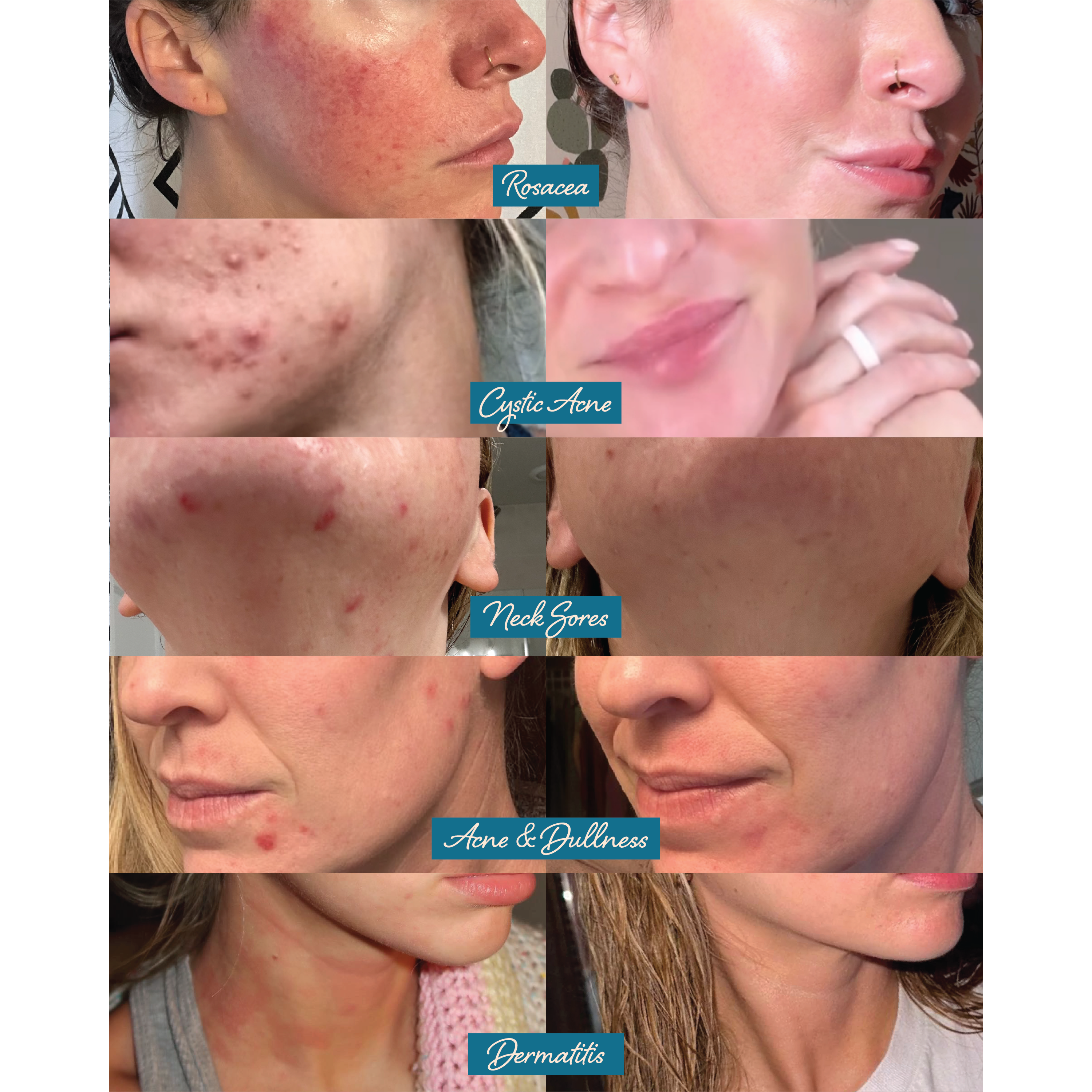 Darlin' Skincare - Wholesale Vochtinbrengende crème voor het gezicht - Talg gezichts balsem met natuurlijke blauwe tanacetum hydraterende crème2