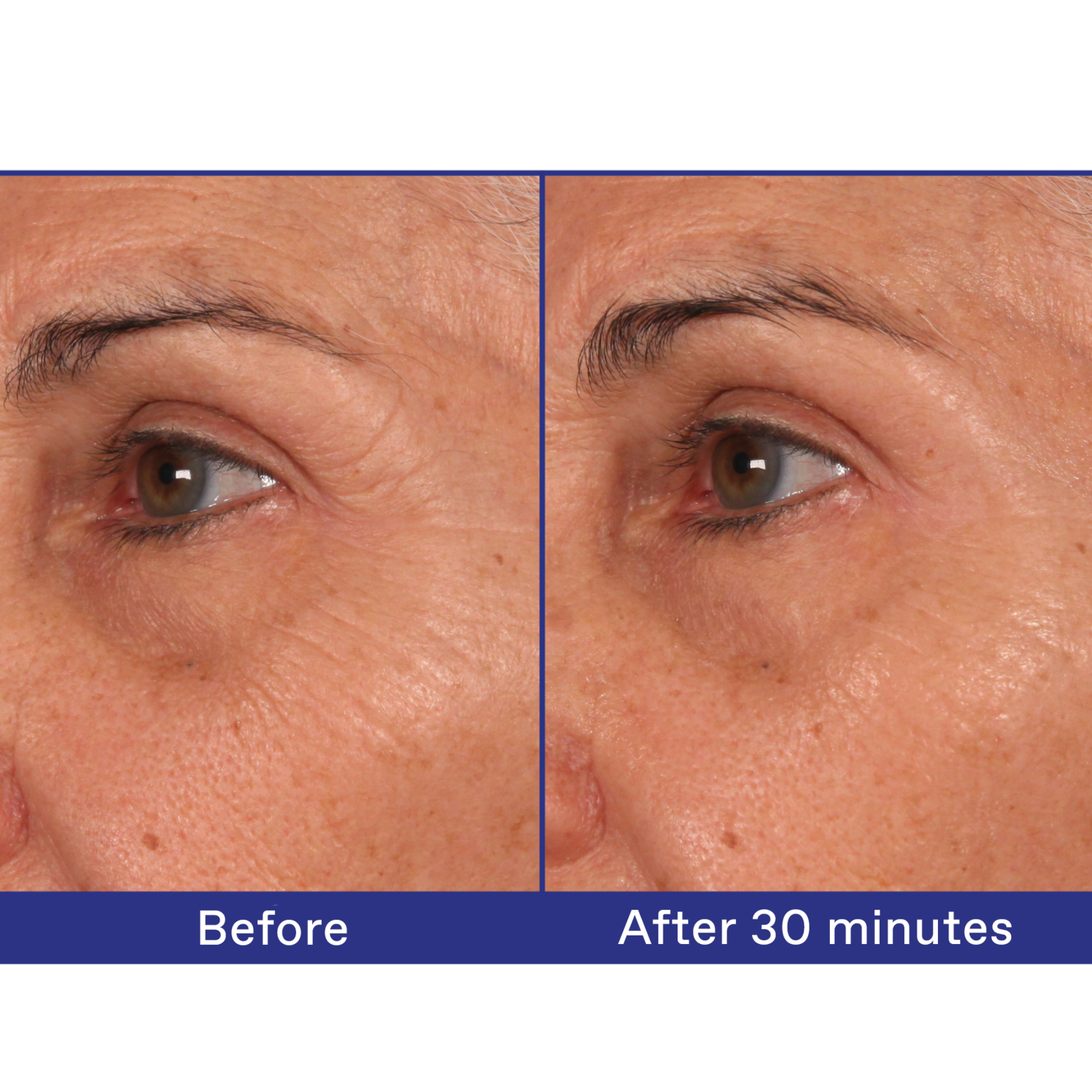 KORRES USA LTD - Wholesale Facial Serum/Concentrate - White Pine Meno-Reverse™ Deep Wrinkle, Plumping + Age Spot Concentrate2