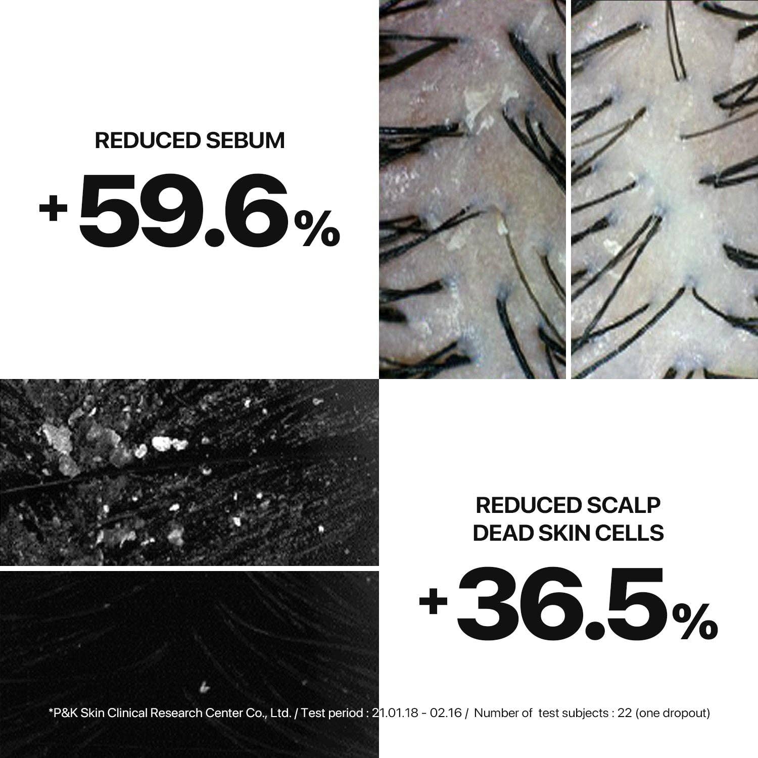 VIAI Beauty – wholesale Scalp/hair treatment – Nature Republic Black Bean Invigorating Hair Treatment2