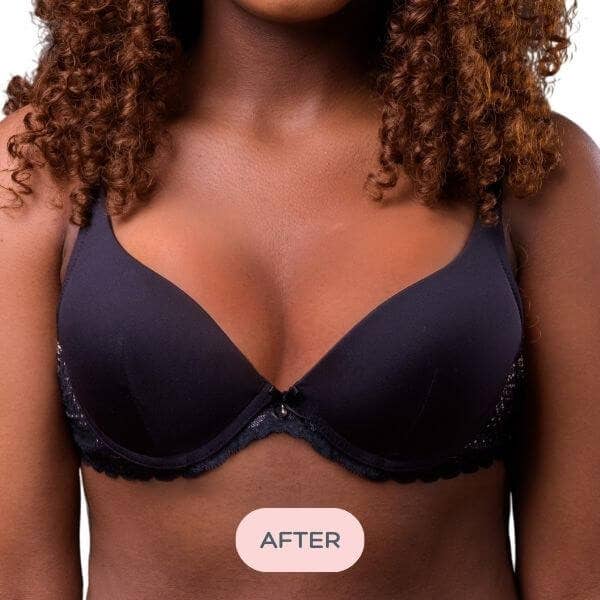 Evenly - Wholesale Bra Inserts - Women's - Bra Balancer™ for Asymmetry - Difference of 1-2 Cup Sizes10