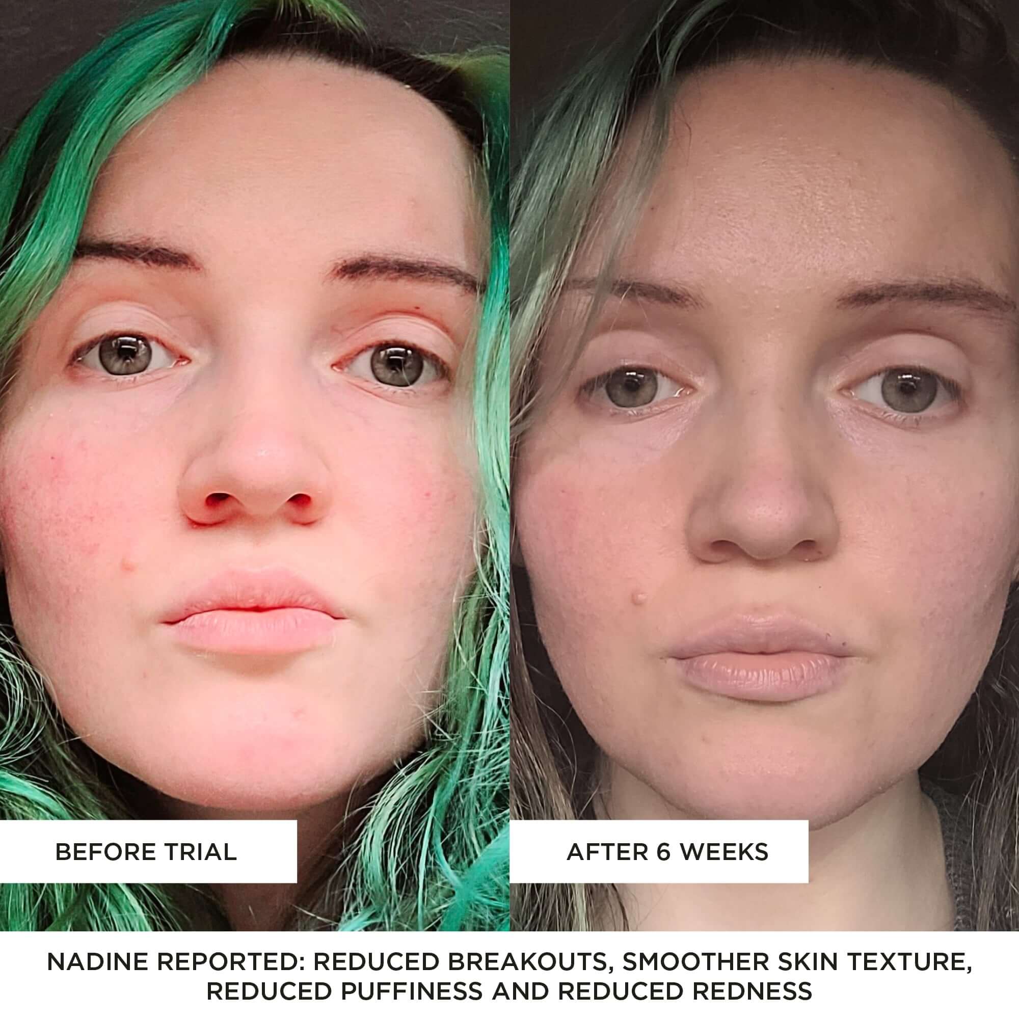 BEAUTYPRO – wholesale Skincare face mask – PHOTON LED Light Therapy Facial Mask7