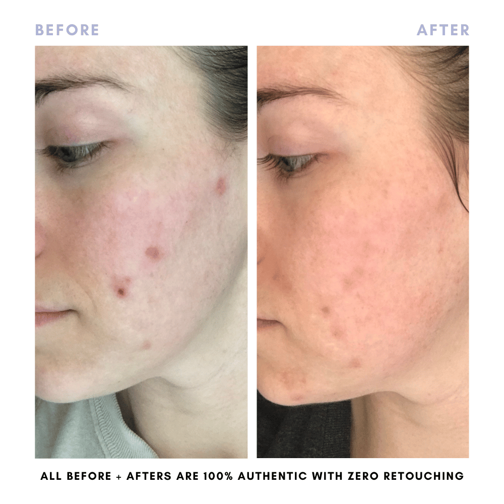 Clover By Clove + Hallow – Großhandel Gesichtspflege-Set – Das Juicy Skin Set7