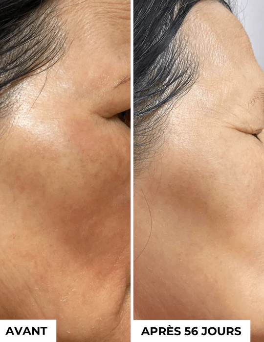 DERMEDEN - Venta al por mayor Sérum facial - Concentrado anti-manchas oscuras4