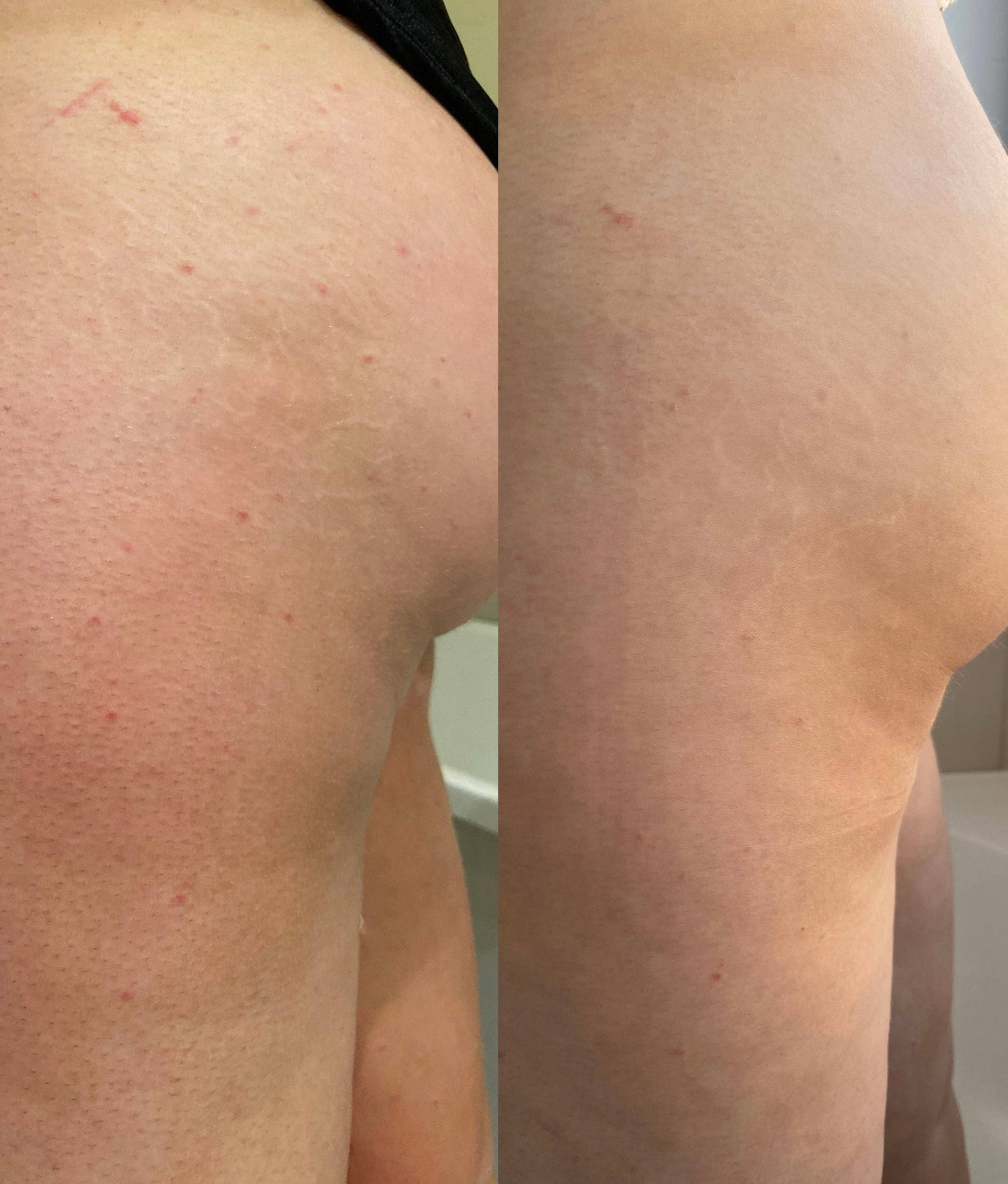 Skinbali Rituals - Venta al por mayor Guantes/manoplas exfoliantes - Guante exfoliante vegano8