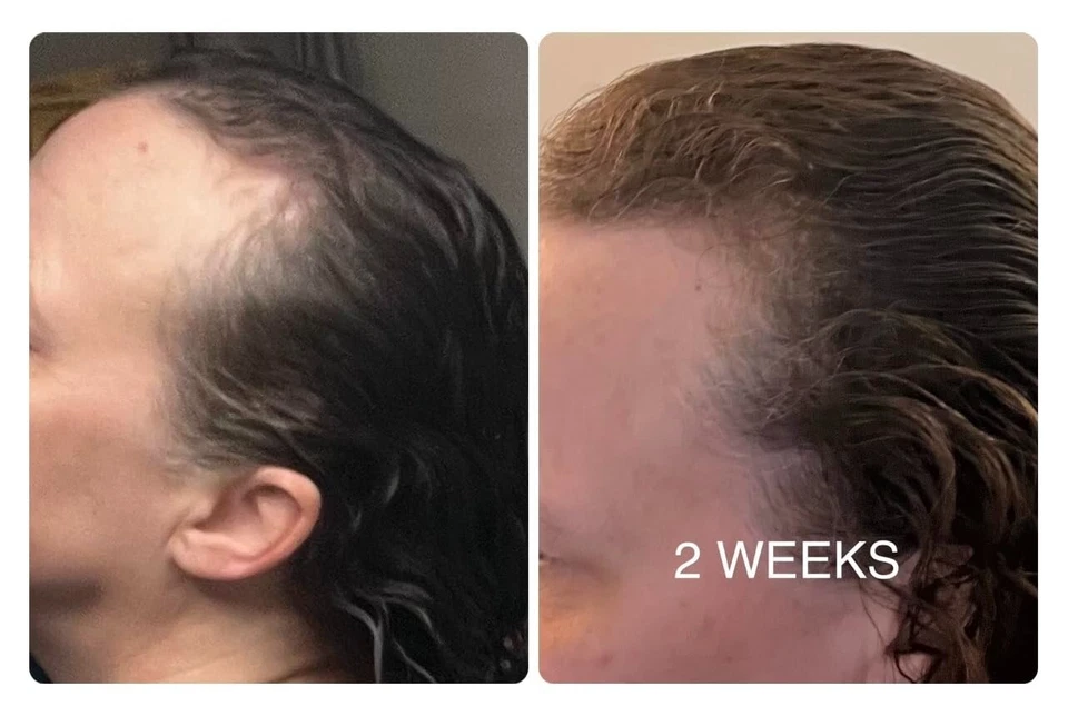 Au Natural Organics – wholesale Hair oil – Bulk Pure Batana Oil for Hair Growth Supplier Honduras 1 ltr8