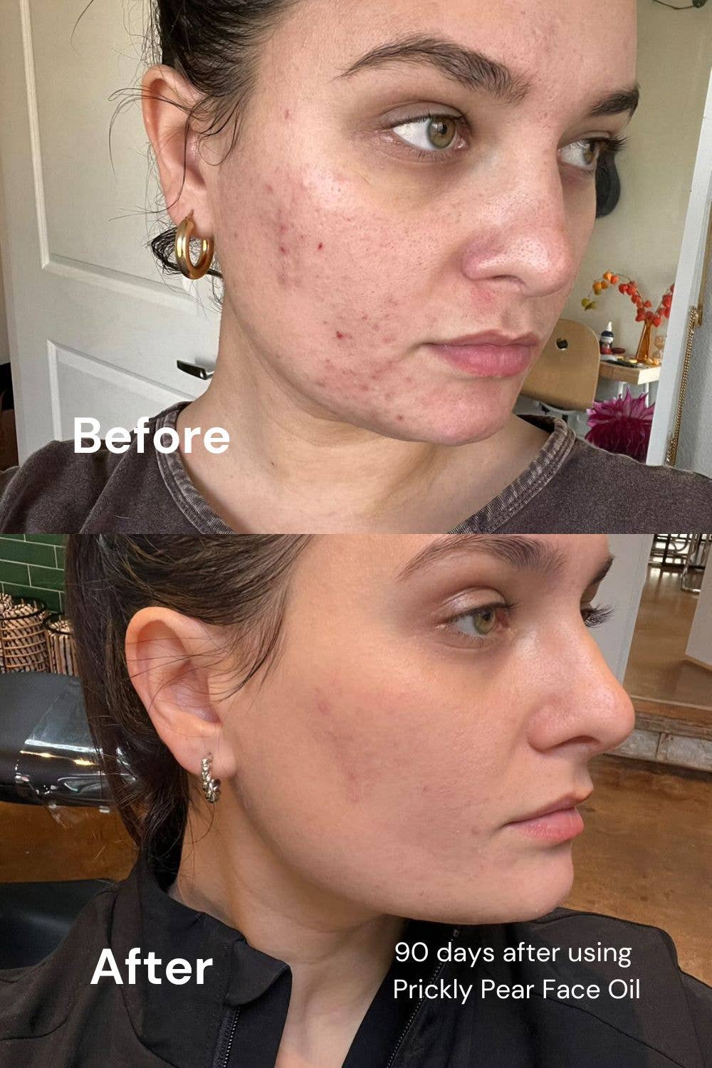 Berlin Skin - Wholesale Facial Oil - Prickly Pear Face Oil2