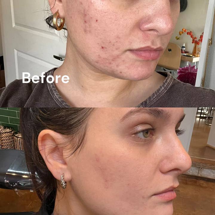 Berlin Skin - Wholesale Facial Oil - Prickly Pear Face Oil2