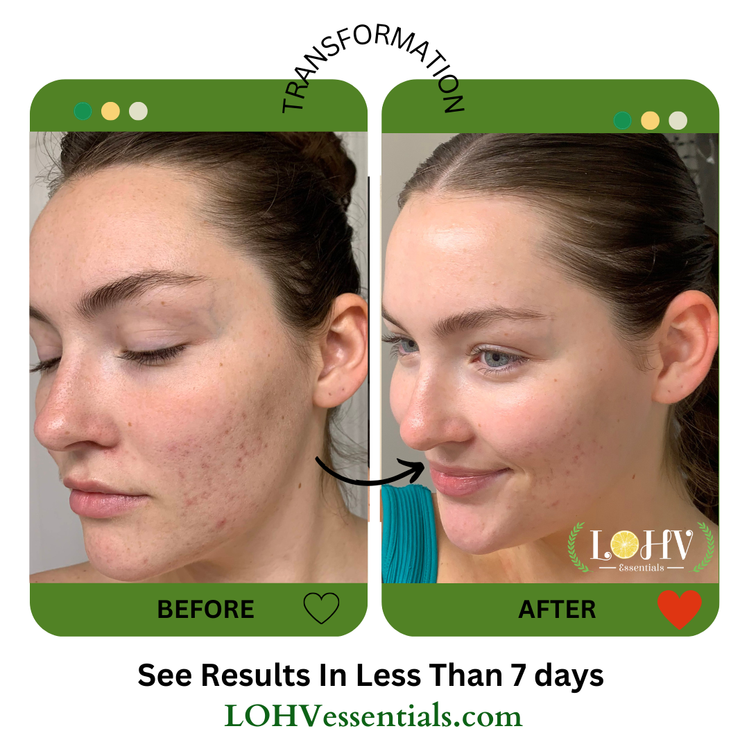 LOHV ESSENTIALS - Wholesale Skincare Face Mask - PREMIUM 100% VEGAN JELLY FACE MASK with Kombucha + Retinol + Turmeric Extract2