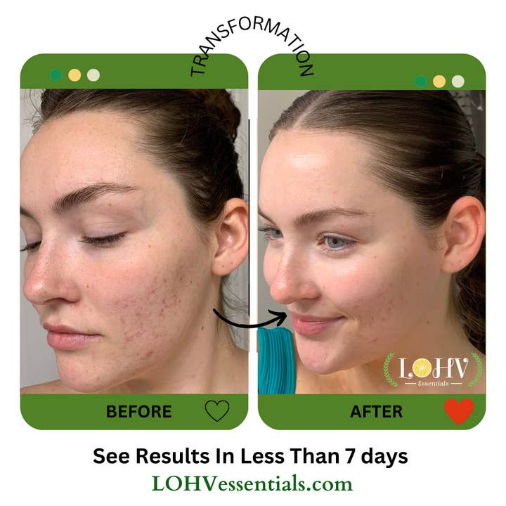 LOHV ESSENTIALS – wholesale Skincare face mask – PREMIUM 100% VEGAN JELLY FACE MASK with Kombucha + Retinol + Turmeric Extract2