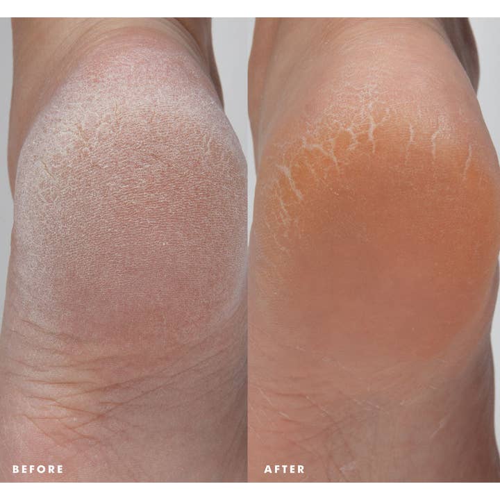 Farmhouse Fresh - Wholesale Foot Cream - Enrich Mint Foot Rescue Mask - Full Size Tester Foot Cream