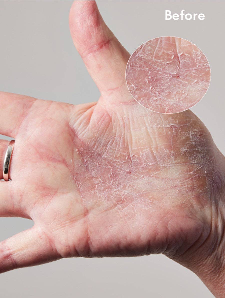 Lanolips - Wholesale Body Cream/Lotion - 101 Dry Skin Super Cream - Multipurpose For Face + Body5