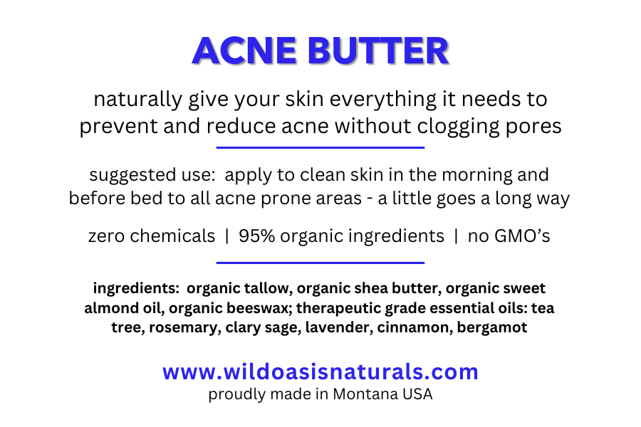 Wild Oasis Naturals - Wholesale Acne/Hydrocolloid Patch - Acne Butter - 2 oz - Organic Tallow Anti-Acne Cream6
