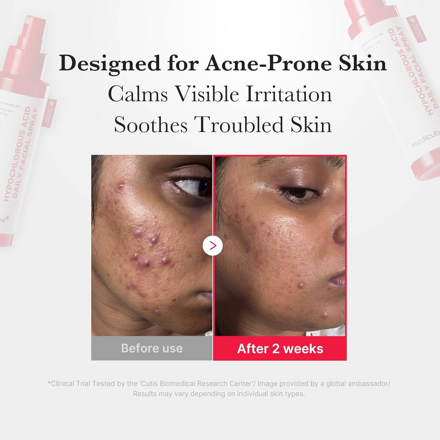 MEHIAZ - Wholesale Face & Body Mist/Water - Medicube Power Soothing Spray with HOCl – 4.22 fl.oz4