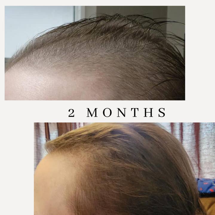 Sutton Michelle Designs - Wholesale Hair Oil - Growth Scalp Oil4