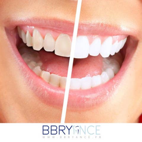 BBryance - Wholesale Teeth Whitener - Tooth whitening gel - mint