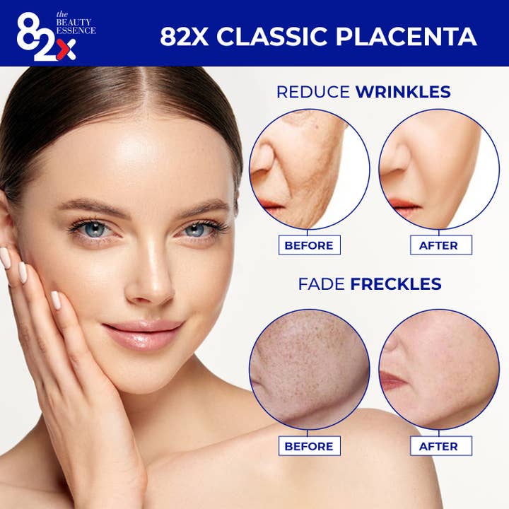 OITA Company Limited - Wholesale Oral Supplement/Vitamin - Classic Placenta 450,000mg Placenta Melasma Treatment Drink2