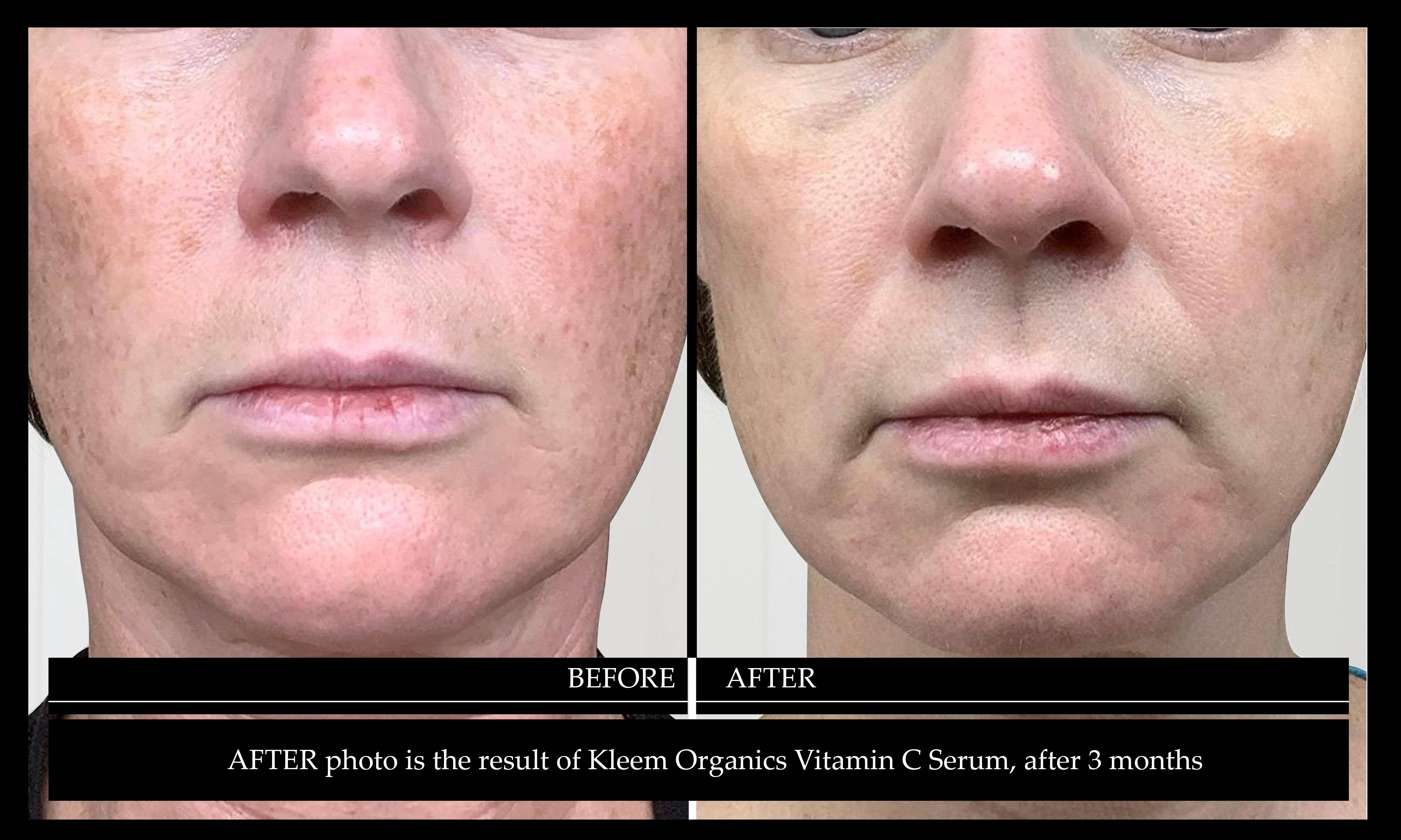 Kleem Organics - Wholesale Facial Serum/Concentrate - Vitamin C Serum6