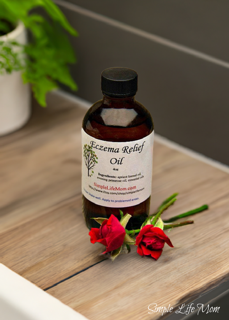 Simple Life Mom - Wholesale Bath/Body Oil - ECZEMA RELIEF OIL - 4oz soothe irritated, dry skin, organic body oil with essential oils, dermatitis oil2