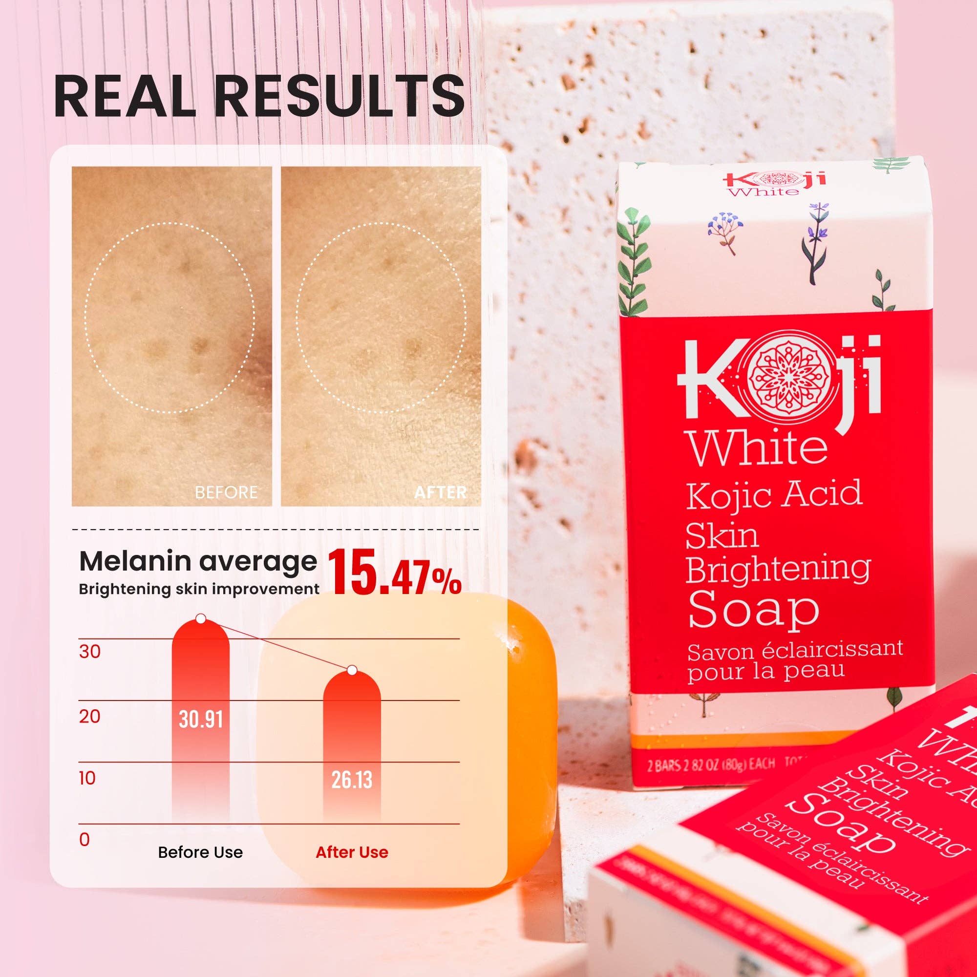 Koji White - Wholesale Bar Soap - Pure 5% Kojic Acid Skin Brightening Soap (2 Bars)2