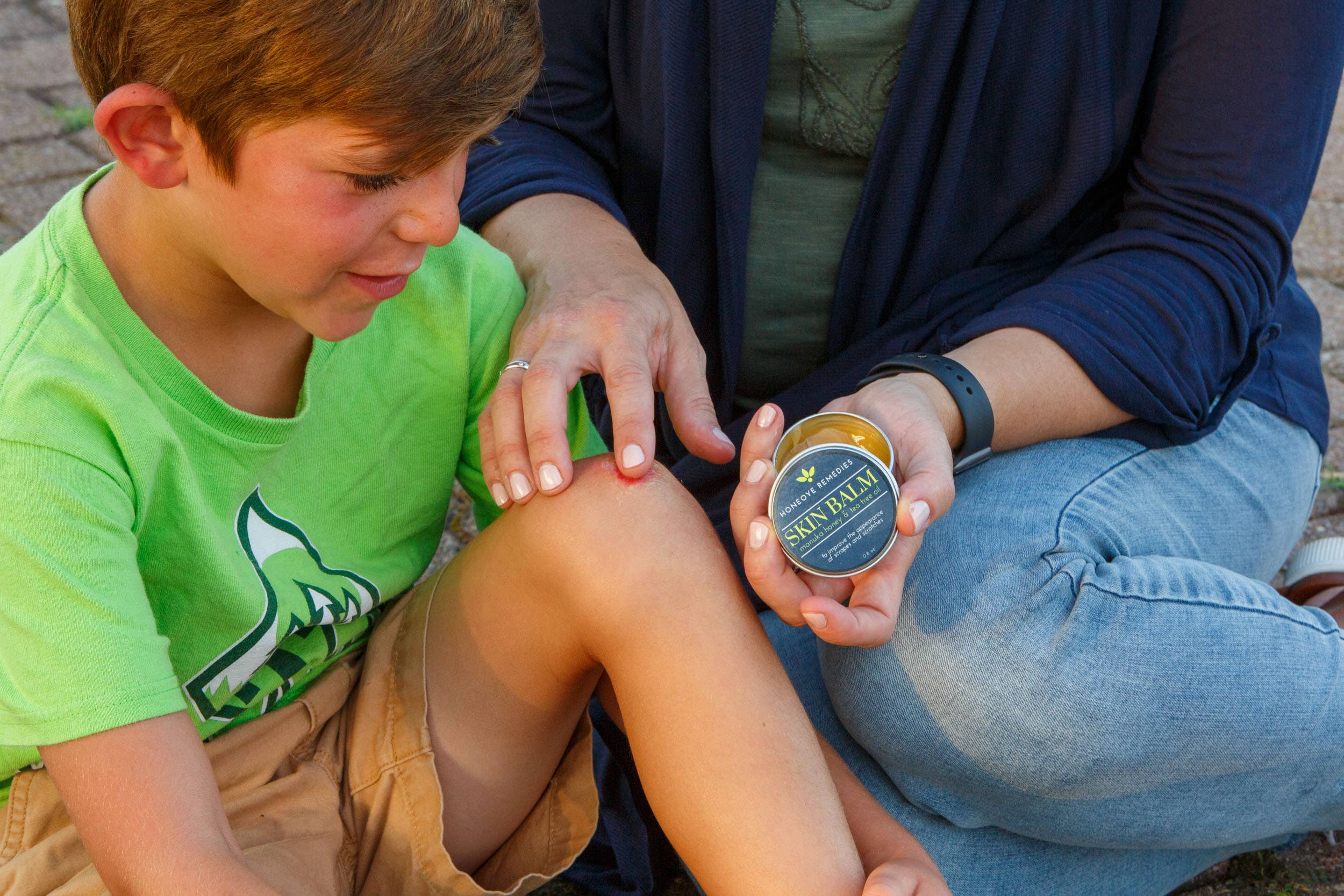Honeoye Remedies - Wholesale Healing Salve/Balm/Cream - .8oz  Skin Balm- Tin6
