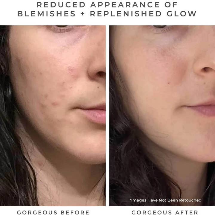 Earth Harbor Naturals - Wholesale Facial Cleanser - OASIS Deep Pore Gel Cleanser: Chlorophyll + Botanical BHA